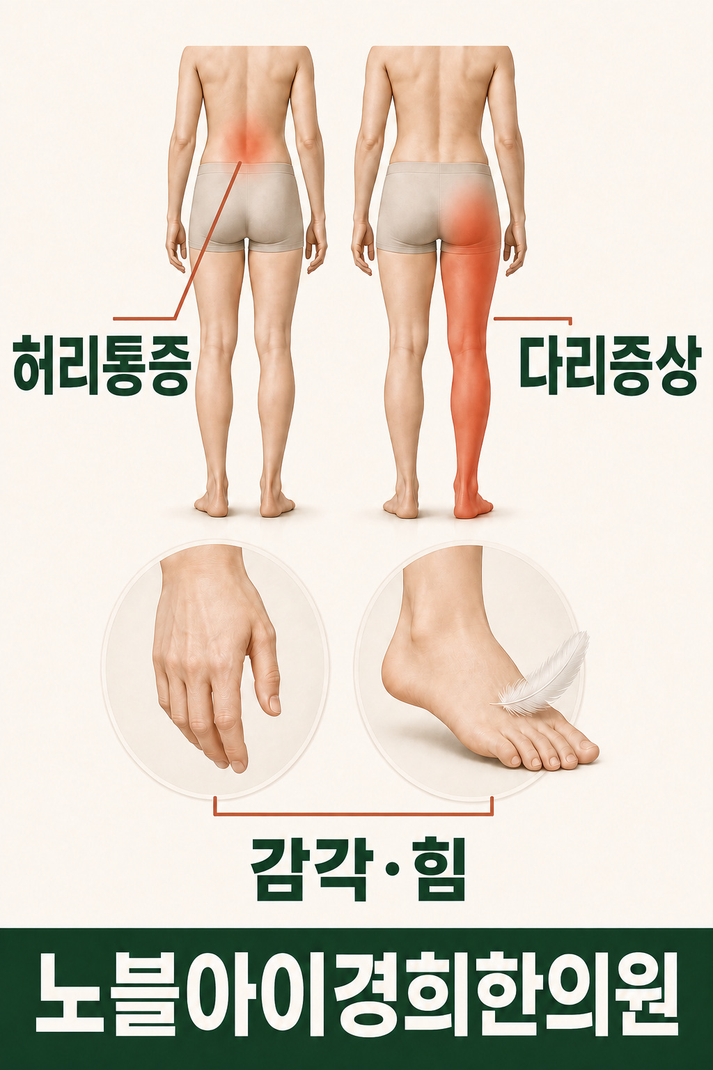 허리에 국한된 통증과 다리까지 이어지는 증상 범위를 나란히 비교하고 감각과 힘을 함께 살피는 개념도