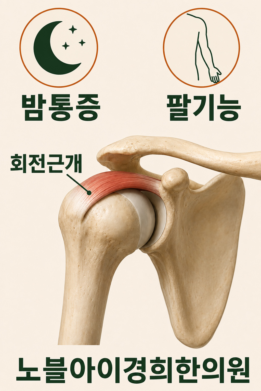 회전근개가 위팔뼈 머리 주변에 놓이는 단순 구조와 밤 통증·팔 기능이라는 별도 관찰 기준을 보여주는 그림