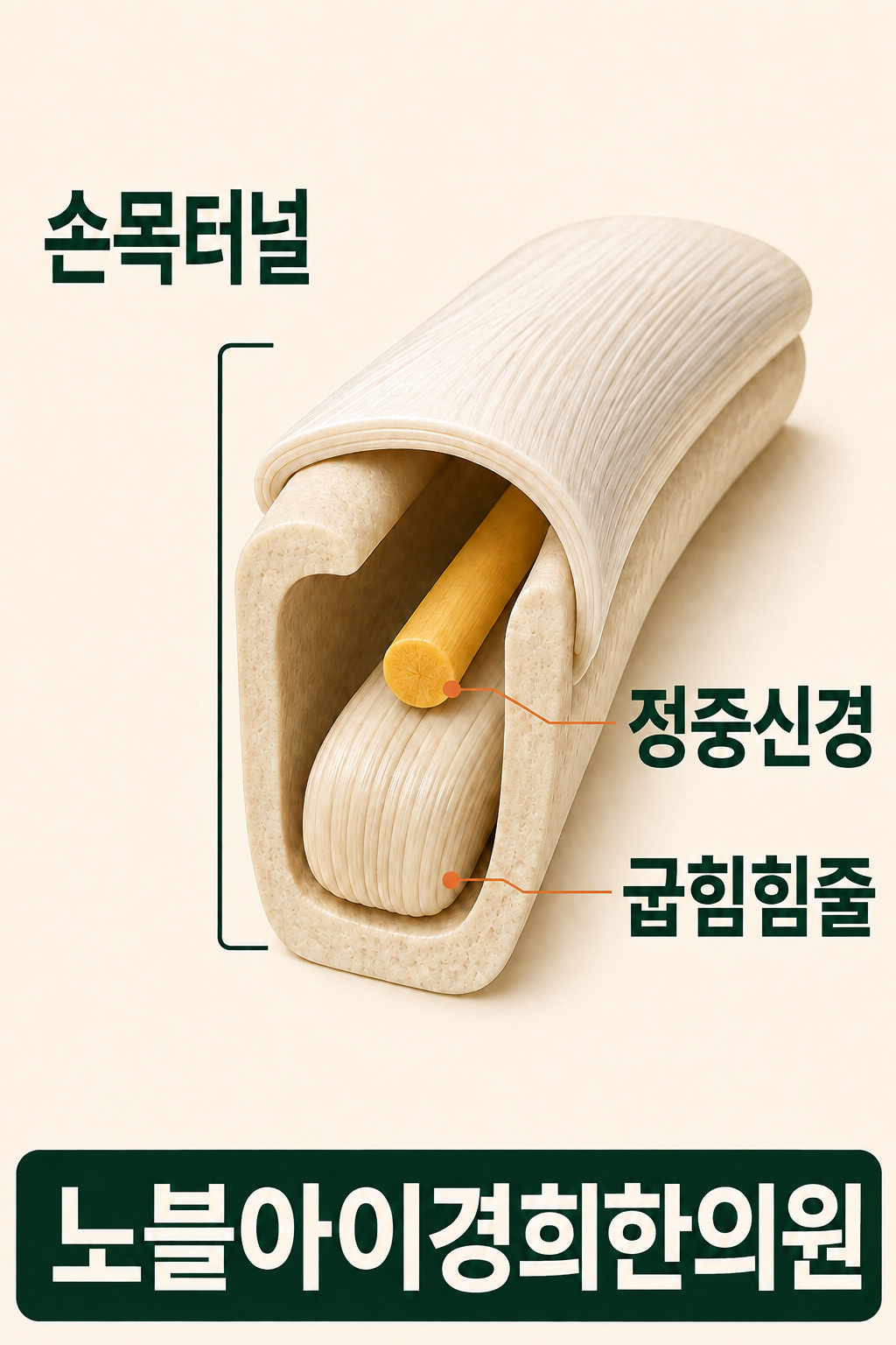 손목터널이라는 같은 공간을 지나는 정중신경과 굽힘힘줄의 관계를 나타낸 단순 구조 모형